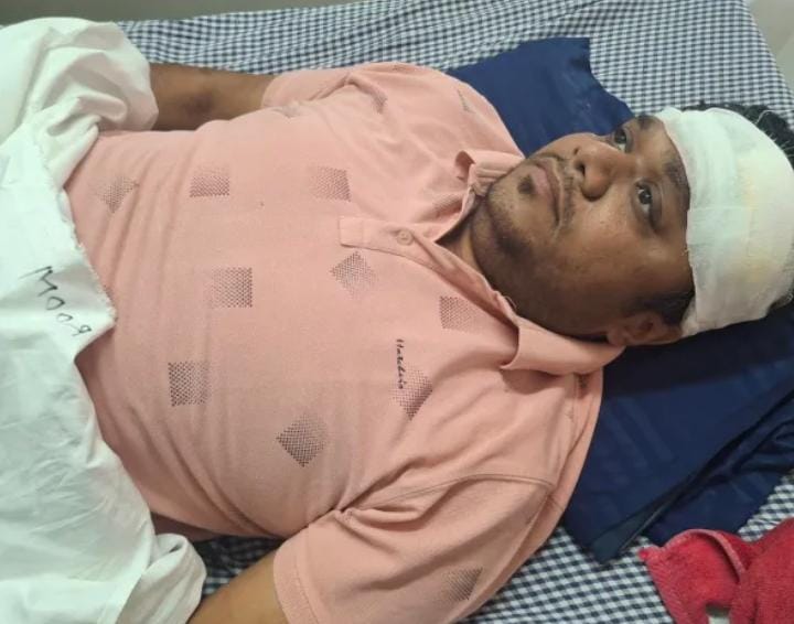 कटनी अपार्टमेंट में शराब माफिया के गुर्गों द्वारा युवक पर हमला